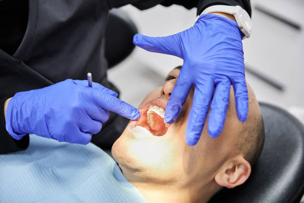 Best Emergency Wisdom Teeth Removal in Rich Hill, MO