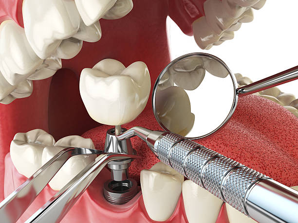 Best After-Hours Emergency Dentist in Rich Hill, MO